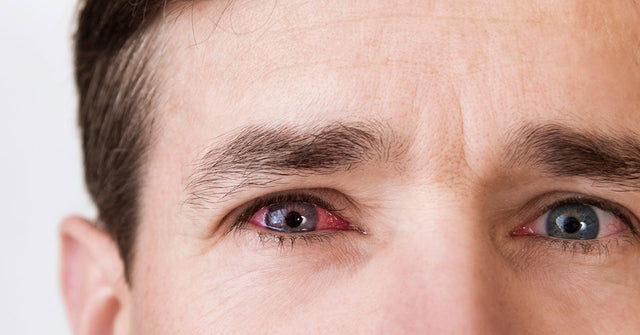 Early signs of balding 10 warning signs and how to stop hair loss
