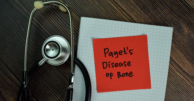 paget's disease of bone — abnormal bone remodeling causing pain, deformity, and fractures