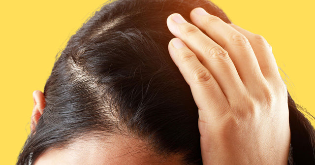 Scabs on Scalp Causes, Symptoms and Treatment for Scalp Infections